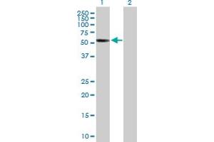 Western Blot analysis of CDYL2 expression in transfected 293T cell line by CDYL2 MaxPab polyclonal antibody. (CDYL2 anticorps  (AA 1-506))