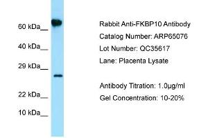 Western Blotting (WB) image for anti-FK506 Binding Protein 10, 65 KDa (FKBP10) (N-Term) antibody (ABIN2790034)