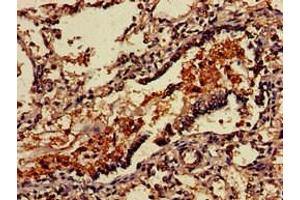 Immunohistochemistry of paraffin-embedded human lung tissue using ABIN7175192 at dilution of 1:100