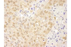 Immunohistochemistry (IHC) image for anti-C-Abl Oncogene 1, Non-Receptor tyrosine Kinase (ABL1) (AA 850-900) antibody (ABIN7448914) (ABL1 anticorps  (AA 850-900))