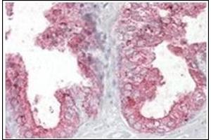 Image no. 1 for anti-Kallikrein 2 (KLK2) (Internal Region) antibody (ABIN374827) (Kallikrein 2 anticorps  (Internal Region))