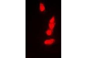 Immunofluorescent analysis of PSMB8 staining in A549 cells. (PSMB8 anticorps)