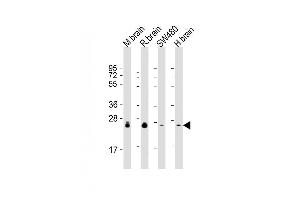 Lane 1: mouse brain lysates, Lane 2: rat brain lysates, Lane 3: SW480 Cell lysates, Lane 4: human brain lysates, probed with RAB3B (1543CT354. (RAB3B anticorps)