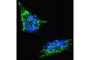Fluorescent confocal image of SY5Y cells stained with LIN28B antibody. (LIN28B anticorps  (AA 1-30))