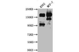Western Blot Positive WB detected in: K562 whole cell lysate, MCF-7 whole cell lysate All lanes: mSin3A antibody at 1:1000 Secondary Goat polyclonal to rabbit IgG at 1/50000 dilution Predicted band size: 146 kDa Observed band size: 146 kDa (Recombinant SIN3A anticorps)