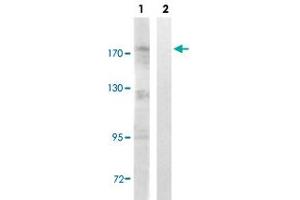Western blot analysis of Lane 1: Untreated Jurkat cell lysates, Lane 2: Synthesized peptide treated Jurkat cell lysates reacted with TOP2A (phospho S1106) polyclonal antibody  at 1:500-1:3000 dilution. (Topoisomerase II alpha anticorps  (pSer1106))