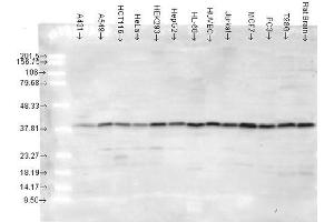 Western blot analysis of Human cancer cell lines showing detection of p38 protein using Rabbit Anti-p38 Polyclonal Antibody . (MAPK14 anticorps  (Atto 488))