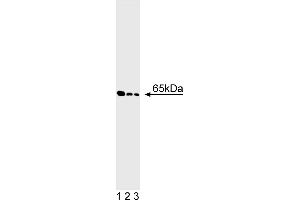 Western Blotting (WB) image for anti-Glutamate Decarboxylase 2 (Pancreatic Islets and Brain, 65kDa) (GAD2) antibody (ABIN967657) (GAD65 anticorps)
