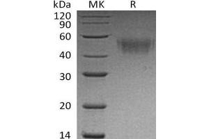 Western Blotting (WB) image for Fc Receptor, IgG, High Affinity I (FCGR1) protein (His tag) (ABIN7320521)