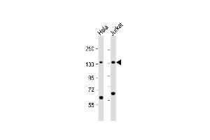 All lanes : Anti-SF3B3 Antibody (C-term) at 1:1000 dilution Lane 1: Hela whole cell lysate Lane 2: Jurkat whole cell lysate Lysates/proteins at 20 μg per lane. (SF3B3 anticorps  (C-Term))