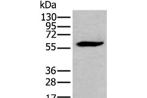 Western blot analysis of LNCAP cell lysate using EGR2 Polyclonal Antibody at dilution of 1:300 (EGR2 anticorps)