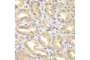 Immunohistochemistry of paraffin-embedded human kidney using ELMO3 antibody.