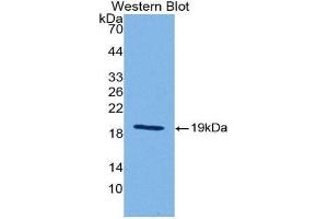 Western Blotting (WB) image for anti-Sonic Hedgehog (SHH) (AA 28-192) antibody (ABIN1175088) (Sonic Hedgehog anticorps  (AA 28-192))