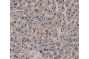 IHC-P analysis of Rat Tissue, with DAB staining. (IL-6 Receptor anticorps  (AA 385-462))