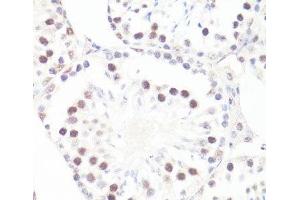 Immunohistochemistry of paraffin-embedded Mouse testis using Phospho-MYC(S62) Polyclonal Antibody at dilution of 1:100 (40x lens).