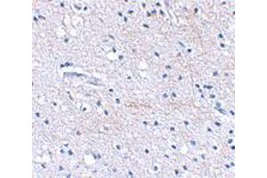 Immunohistochemical staining of human brain tissue using FBXL20 polyclonal antibody  at 2. (FBXL20 anticorps  (C-Term))
