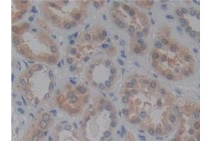 Detection of ACE in Human Kidney Tissue using Polyclonal Antibody to Angiotensin I Converting Enzyme (ACE) (Angiotensin I Converting Enzyme 1 anticorps  (AA 1160-1306))