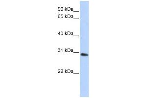 WB Suggested Anti-BPGM Antibody Titration: 0. (BPGM anticorps  (C-Term))