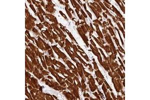 Immunohistochemical staining of human heart muscle with MYH15 polyclonal antibody  shows strong cytoplasmic positivity in myocytes. (MYH15 anticorps)
