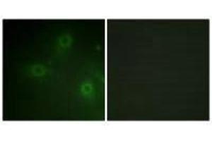 Immunofluorescence analysis of HeLa cells, using Neutrophil Cytosol Factor 1 (Ab-304) antibody.
