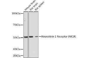 Western blot analysis of extracts of various cell lines, using Neurokinin 1 Receptor (NK1R) (NK1R) Rabbit mAb (ABIN7270711) at 1:1000 dilution.