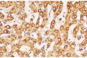Immunohistochemistry of paraffin-embedded Human liver using FGG Polycloanl Antibody at dilution of 1:200 (FGG anticorps)