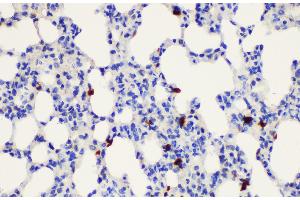 Immunohistochemistry of paraffin-embedded Rat lung using S100a8 Polycloanl Antibody at dilution of 1:200 (S100A8 anticorps)