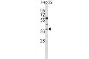 Western Blotting (WB) image for anti-Endonuclease 8-like 2 (NEIL2) antibody (ABIN5018074) (NEIL2 anticorps)