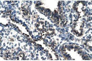 Rabbit Anti-TSC22D4 Antibody Catalog Number: ARP30107 Paraffin Embedded Tissue: Human Lung Cellular Data: Alveolar cells Antibody Concentration: 4. (TSC22D4 anticorps  (N-Term))