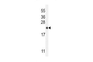 Western blot analysis in mouse liver tissue lysates (35ug/lane). (hCG_2024410 (AA 187-215), (C-Term) anticorps)