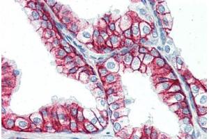 Human Prostate (formalin-fixed, paraffin-embedded) stained with BSG antibody ABIN396957 at 10 ug/ml followed by biotinylated anti-mouse IgG secondary antibody ABIN481714, alkaline phosphatase-streptavidin and chromogen. (CD147 anticorps)