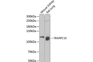 Western blot analysis of extracts of various cell lines, using TR antibody (ABIN6129150, ABIN6149471, ABIN6149472 and ABIN6222518) at 1:1000 dilution. (TRAPPC10 anticorps  (AA 1-260))