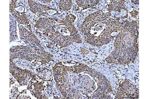 IHC analysis of TFEB using anti-TFEB antibody (ABIN7600648).