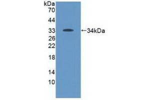 Detection of Recombinant Tyk2, Human using Polyclonal Antibody to Tyrosine Kinase 2 (Tyk2) (TYK2 anticorps  (AA 915-1173))