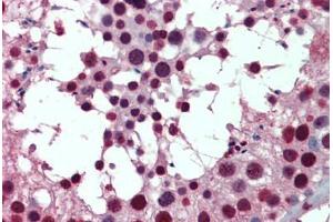 anti-RNA Binding Motif Protein 8A (RBM8A) (AA 1-175) antibody