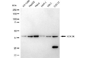 Western blotting analysis using BCKDK antibody (ABIN7797783).