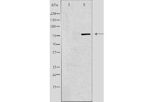 Western blot analysis of extracts from Jurkat cells using ARNT2 antibody. (ARNT2 anticorps  (N-Term))