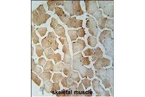SRBD1 Antibody (C-term) (ABIN655006 and ABIN2844641) immunohistochemistry analysis in formalin fixed and paraffin embedded human skeletal muscle followed by peroxidase conjugation of the secondary antibody and DAB staining. (SRBD1 anticorps  (C-Term))