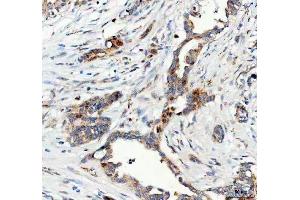 IHC analysis of FOXO3A using anti-FOXO3A antibody (ABIN3042404). (FOXO3 anticorps  (AA 471-673))