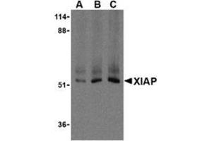 Western blot analysis of XIAP in Human kidney lysate using AP30993PU-N XIAP antibody at 0. (XIAP anticorps  (C-Term))