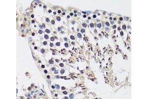 Immunohistochemistry of paraffin-embedded Rat testis using CASC5 Polyclonal Antibody at dilution of 1:100 (40x lens). (CASC5 anticorps)