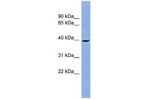 ACPP antibody used at 1 ug/ml to detect target protein. (ACPP anticorps  (Middle Region))