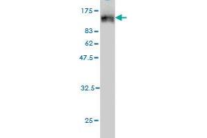 Western Blot detection against Immunogen (120. (TOP3B anticorps  (AA 1-862))