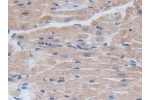 Detection of BRD8 in Mouse Heart Tissue using Polyclonal Antibody to Bromodomain Containing Protein 8 (BRD8)