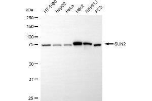 Western blotting analysis using SUN2 antibody (ABIN7800269).
