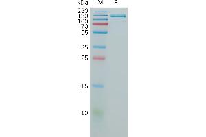 Human CD106 Protein, hFc Tag on SDS-PAGE under reducing condition.