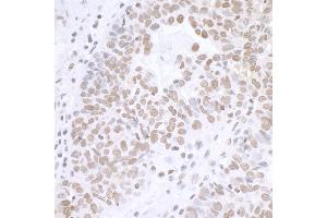 Immunohistochemistry (IHC) image for anti-Breast Carcinoma Amplified Sequence 2 (BCAS2) (C-Term) antibody (ABIN7453423)