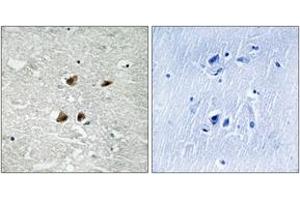 Immunohistochemistry analysis of paraffin-embedded human brain, using HSF1 (Phospho-Ser121) Antibody. (HSF1 anticorps  (pSer121))