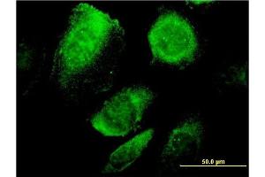 Immunofluorescence of monoclonal antibody to BCAP29 on HeLa cell. (BCAP29 anticorps  (AA 125-241))