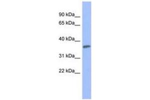 Image no. 1 for anti-Protein Kinase C, gamma (PRKCG) (AA 539-588) antibody (ABIN6741659) (PKC gamma anticorps  (AA 539-588))